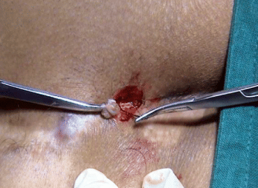 Sawkar Ayurvedic Medical College & Hospital Satara Some Moments photo 9